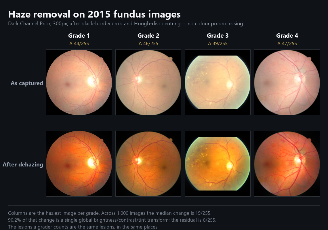 2015 fundus images before and after Dark Channel Prior dehazing